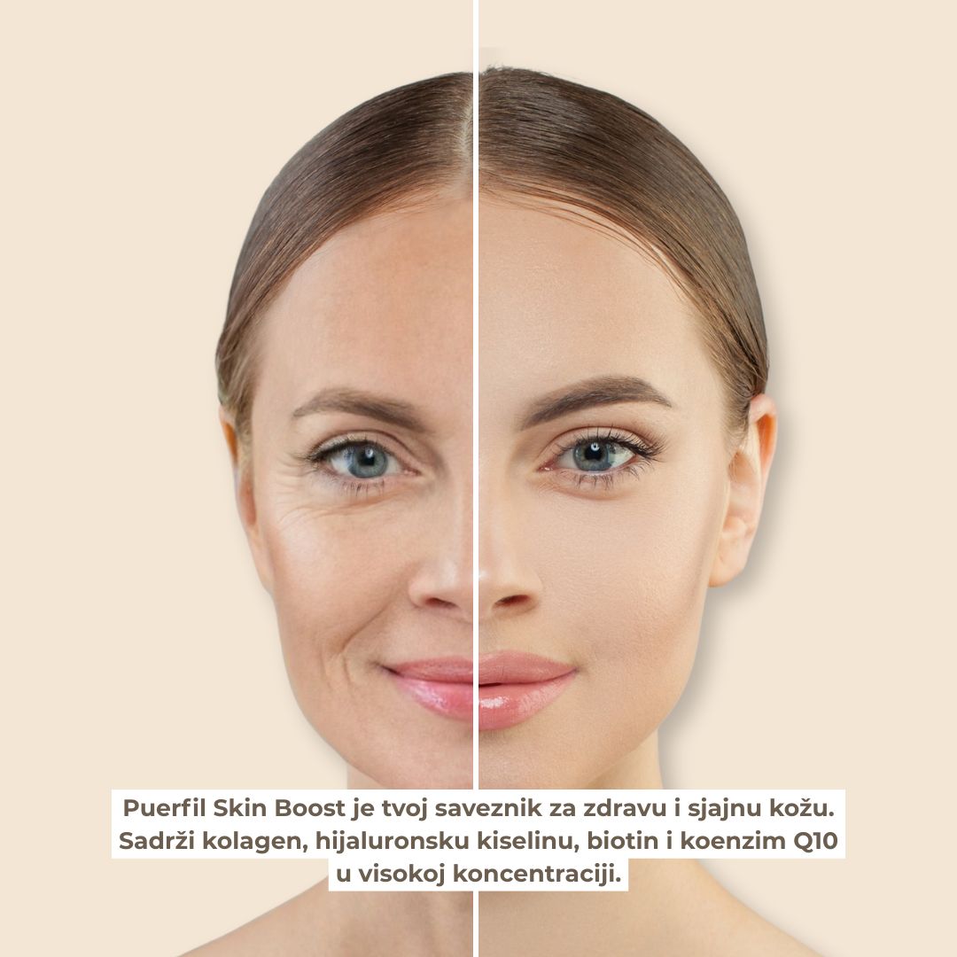 Skin Glow iznutra: Puerfil Skin Boost