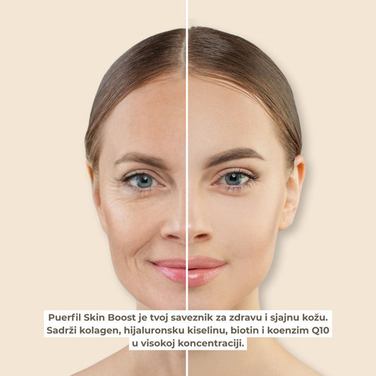 Skin Glow iznutra: Puerfil Skin Boost